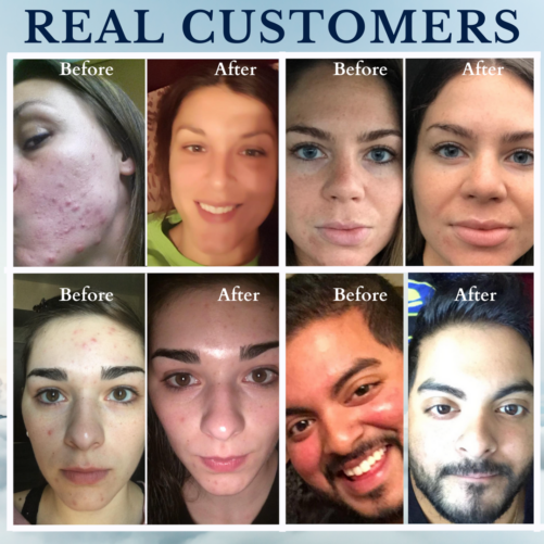 Real before and after from customers