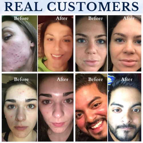 Real Customers Before and After Images